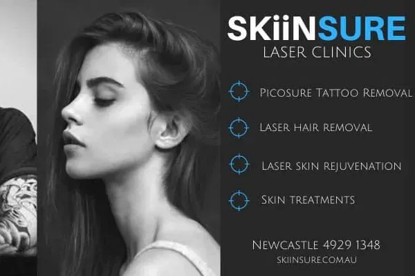 SKiiNsure Laser and Skin Rejuvenation Clinic